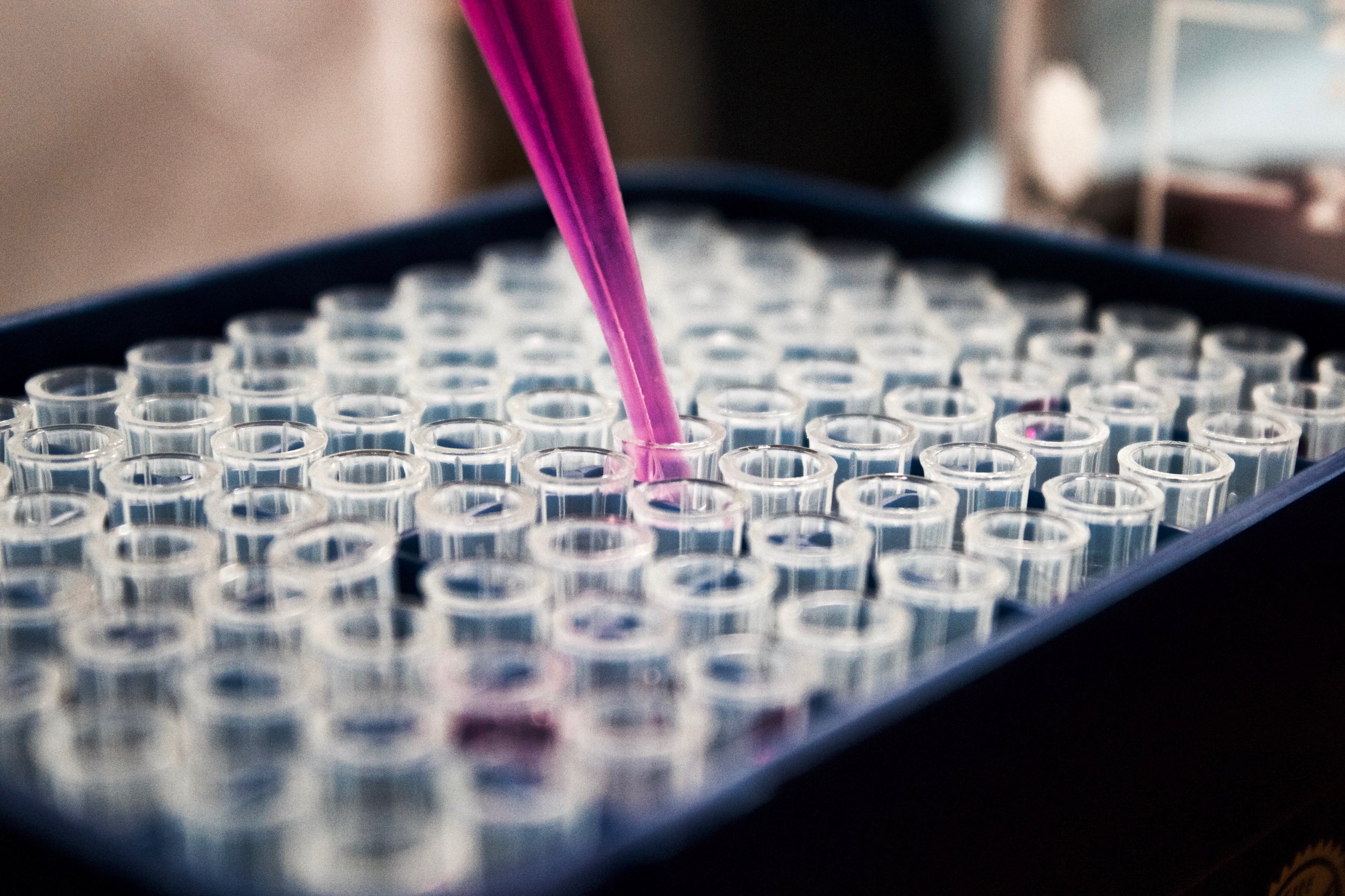 Image of test tube rack, with a pipette extracting liquid out of one of the tubes